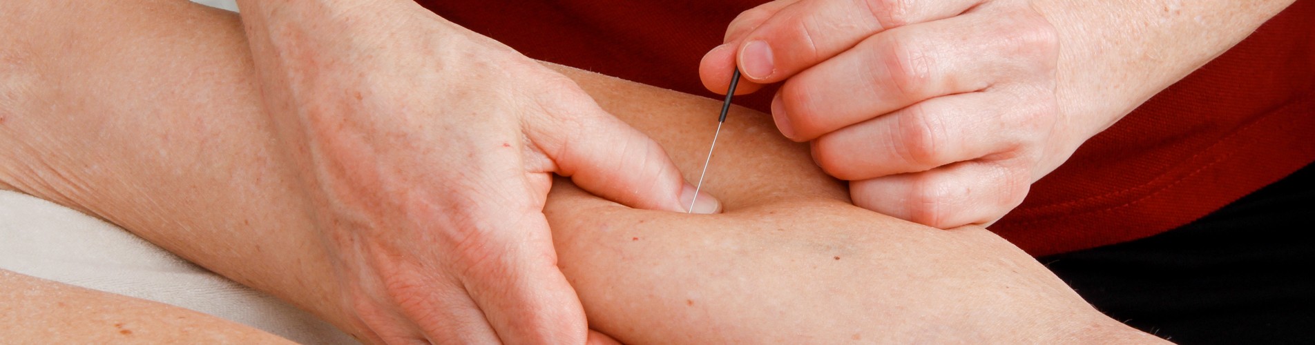 Header Manuell Dry Needling